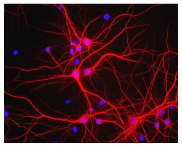 Immunofluorescence: Mixed neuron/glial cultures. The perikarya and dendrites of neurons are strongly and specifically stained with ARG52328 anti-MAP2 antibody (red). Cell nuclei are visualized with DAPI DNA stain.