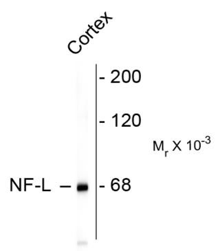 Western blot: rat cortex lysate stained with ARG52348 anti-Neurofilament NF-L antibody [DA2] showing specific immunolableing of the ~ 68k NF-L protein.
