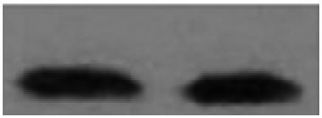 Western Blot: PSA antigen (100 ng/well) stained with anti-PSA antibody [CHYH1] (ARG10192) at 1ug/mL