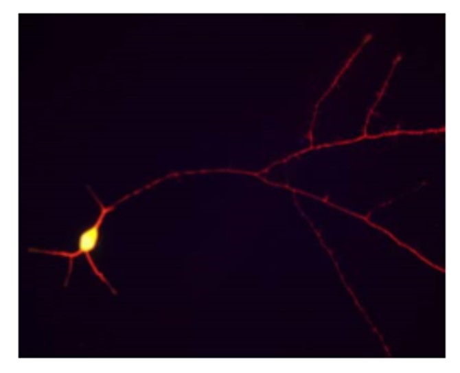 Immunofluorescence: cultured rat hippocampal neurons stained with Tau antibody (ARG52441) showing staining of tau in red along the neuronal processes. Immunofluorescence: cultured rat hippocampal neurons stained with Tau antibody (ARG52441) showing staining of tau in red along the neuronal processes.