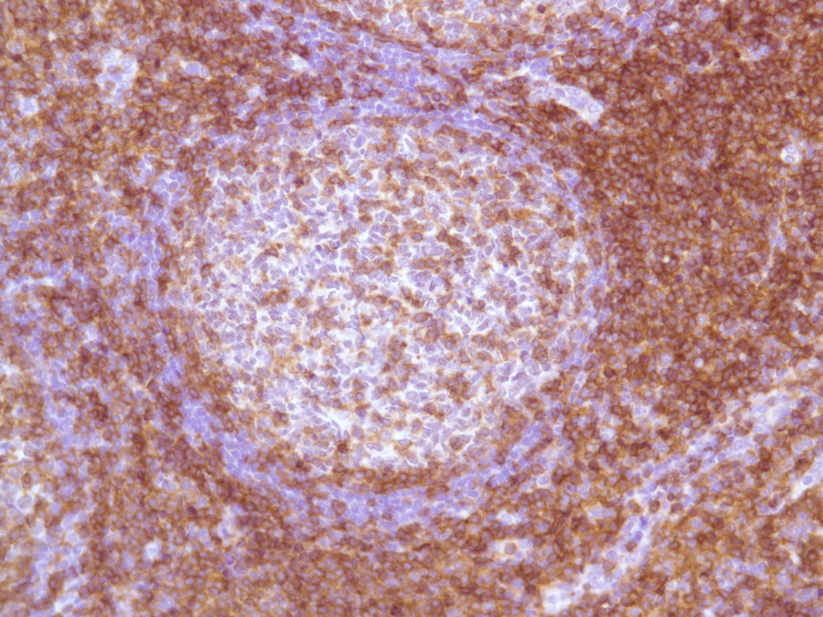 Immunohistochemistry: Human Tonsil stained with CD4 antibody [SP35] (ARG52768)