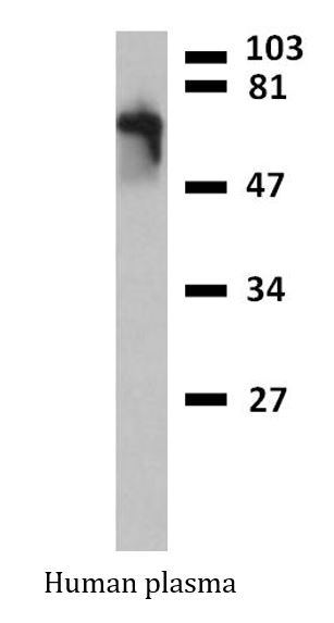 Western blot: Human plasma lysate stained with ARG54237 anti-IgM antibody [CH2] (Peroxidase), in reducing conditions.