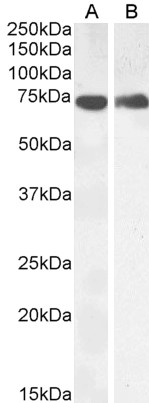Western blot: 35 microg of Mouse kidney (A) and skeletal muscle (B) lysates (in RIPA buffer) stained with ARG63193 anti-COX1 antibody at 0.5 microg/ml dilution and incubated at RT for 1 hour.
