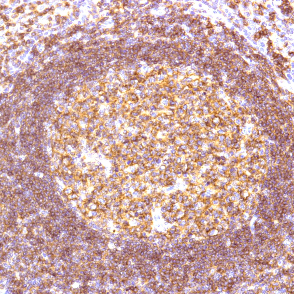 Immunohistochemistry: Human Tonsil stained with CD19 antibody (ARG52706) Immunohistochemistry: Human Tonsil stained with CD19 antibody (ARG52706)