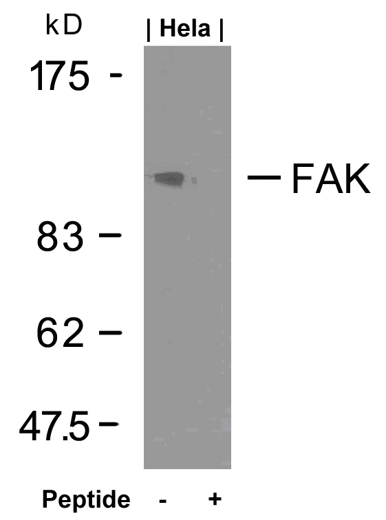 Western Blot: extracts from HeLa cells stained with anti-FAK antibody ARG51136 and the same antibody preincubated with blocking peptide. Western Blot: extracts from HeLa cells stained with anti-FAK antibody ARG51136 and the same antibody preincubated with blocking peptide.